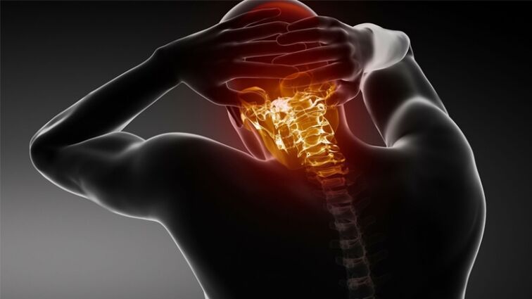 bolest v zadní části hlavy s cervikální osteochondrózou